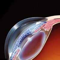 La Chirurgia Del Glaucoma Ad Angolo Aperto
