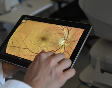 Patologie Oculari
